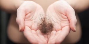 “毛发银行”来了，脱发秃顶的人有救了吗？